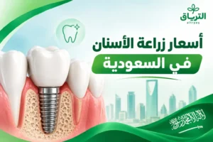 أسعار زراعة الاسنان في السعودية 2026: التكلفة وأهم الأنواع