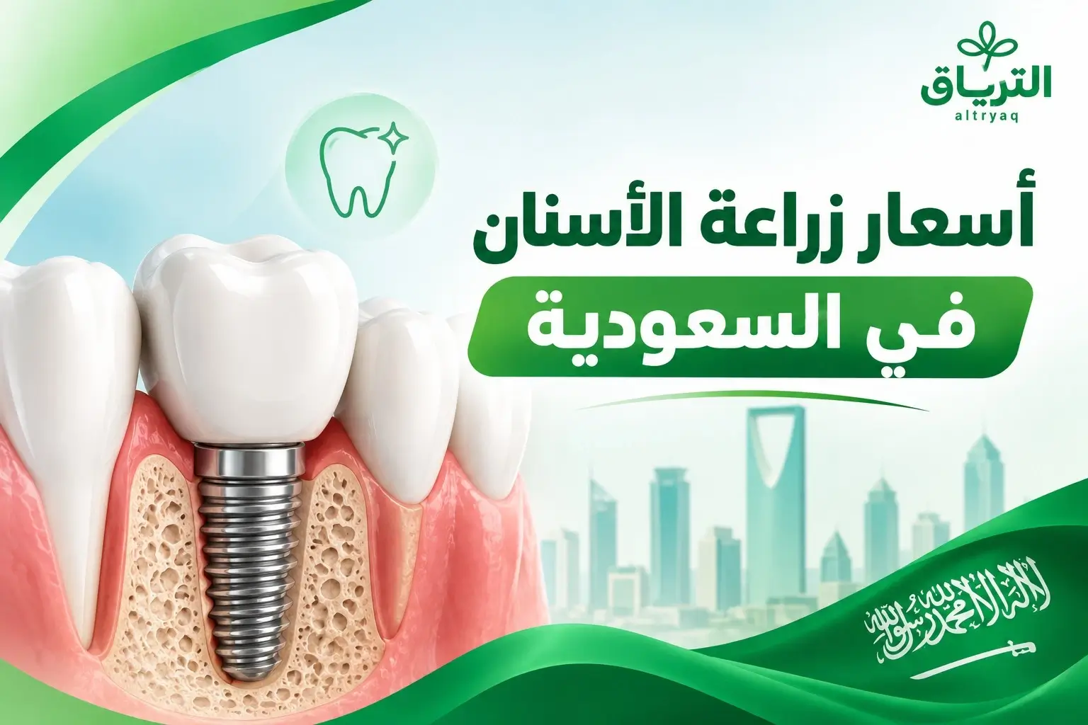 أسعار زراعة الاسنان في السعودية