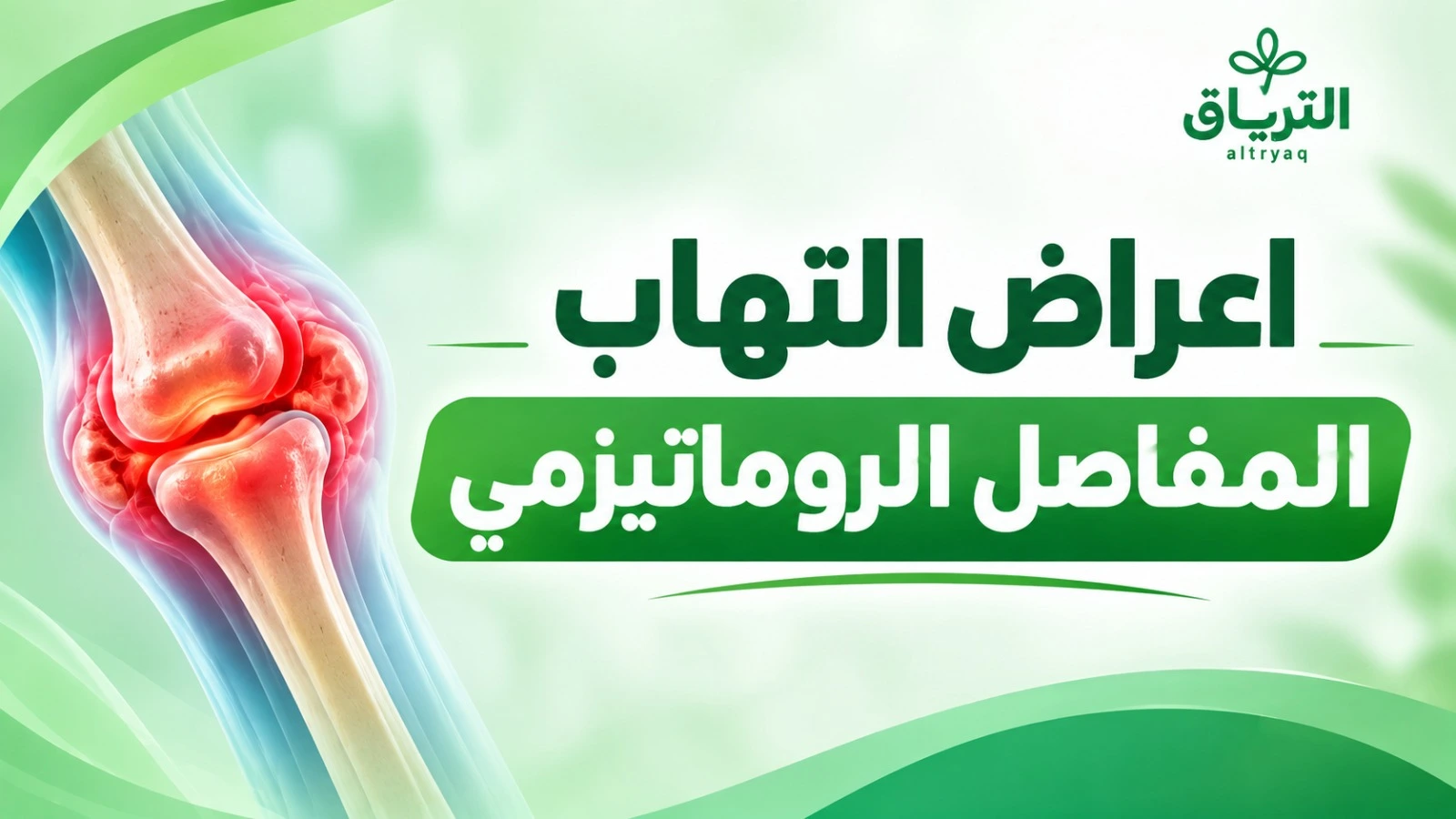 أعراض التهاب المفاصل الروماتيزمي
