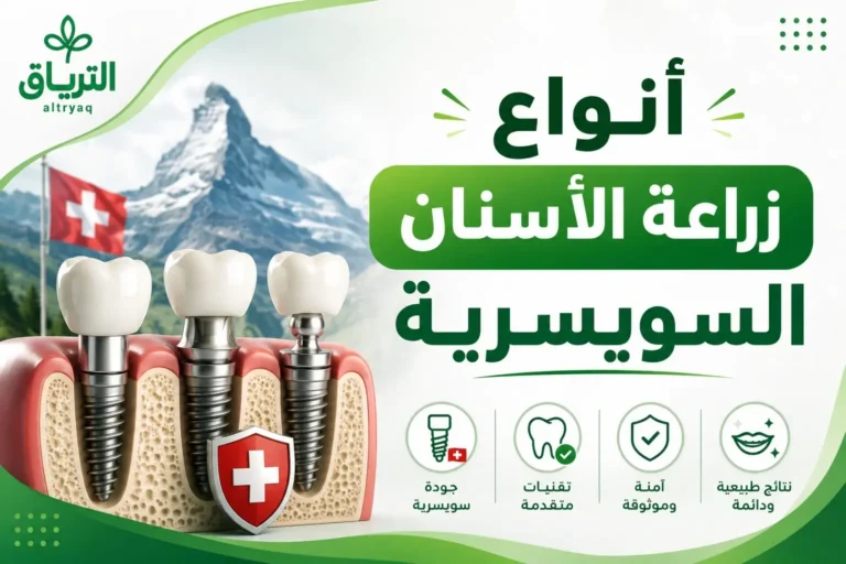 أنواع زراعة الأسنان السويسرية