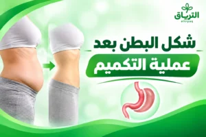 شكل البطن بعد عملية التكميم: التغيرات والنتائج المتوقعة