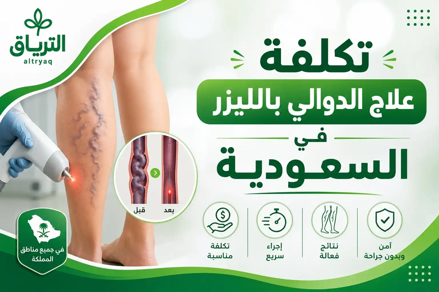 تكلفة علاج الدوالي بالليزر في السعودية