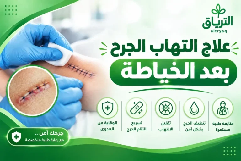 علاج التهاب الجرح بعد الخياطة